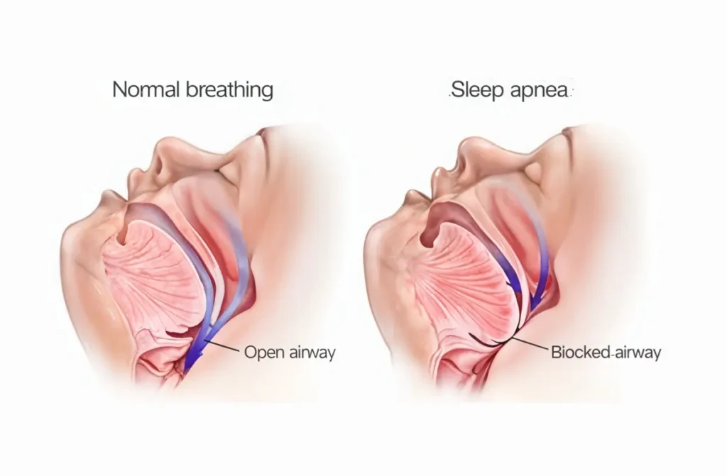 Airway Dentistry & ENT