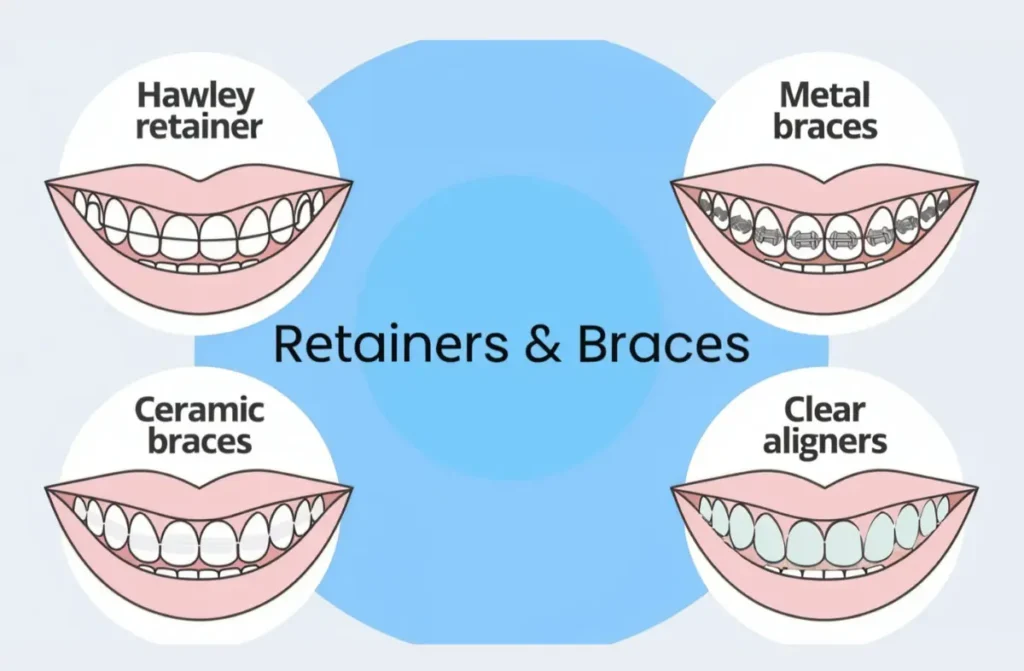 orthodontics-aligners