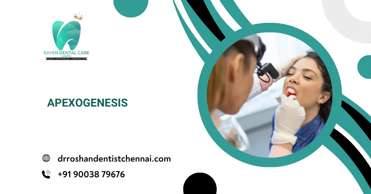 Apexogenesis