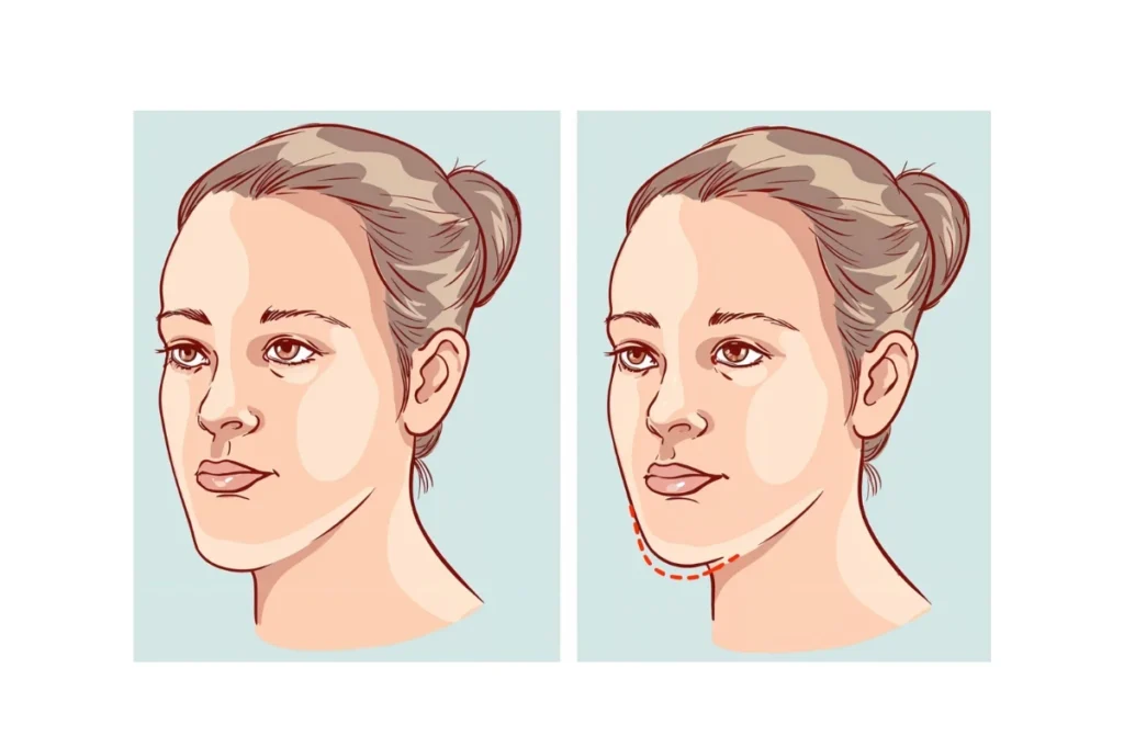 Oral and Maxillofacial Surgeons in Chennai