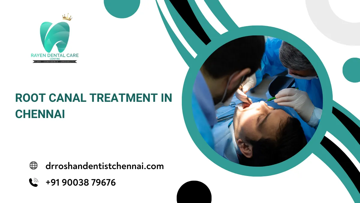 Root Canal Treatment in Chennai