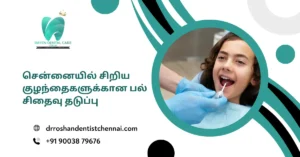 சென்னையில் சிறிய குழந்தைகளுக்கான பல் சிதைவு தடுப்பு