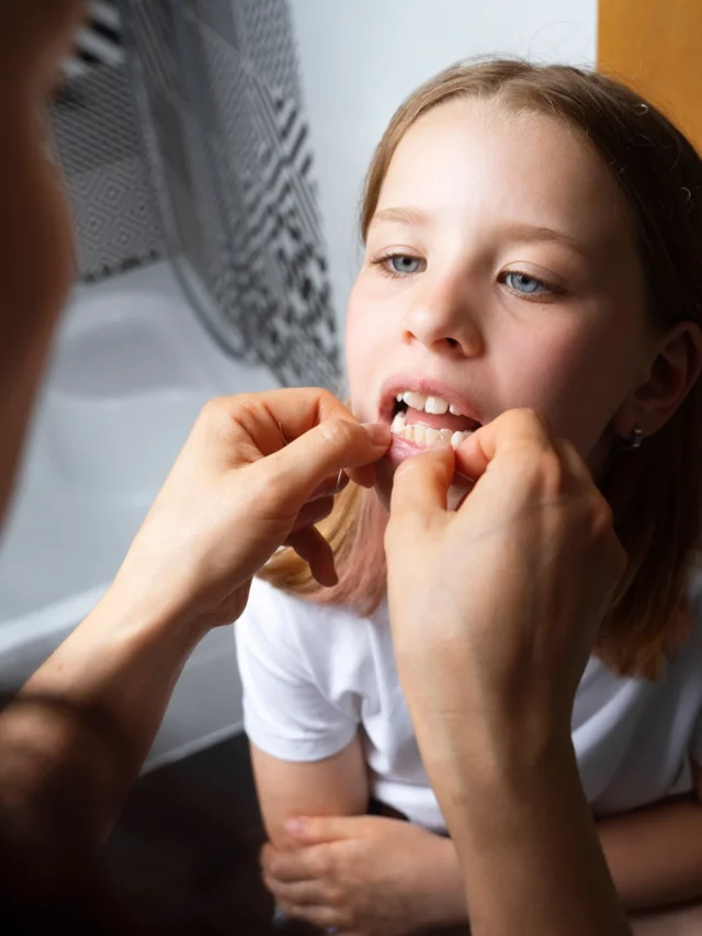 Impact of Mouth Breathing on Oral Health in Childrens
