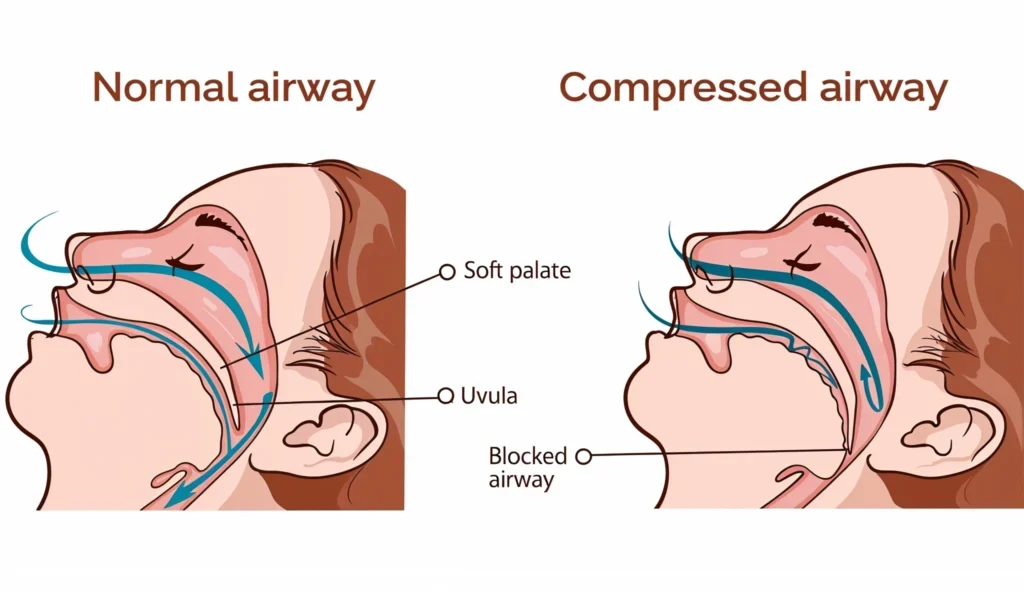 Airway focused orthodontic