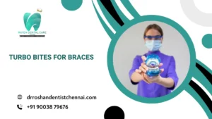 Turbo Bites for Braces
