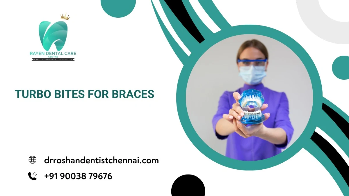 Turbo Bites for Braces