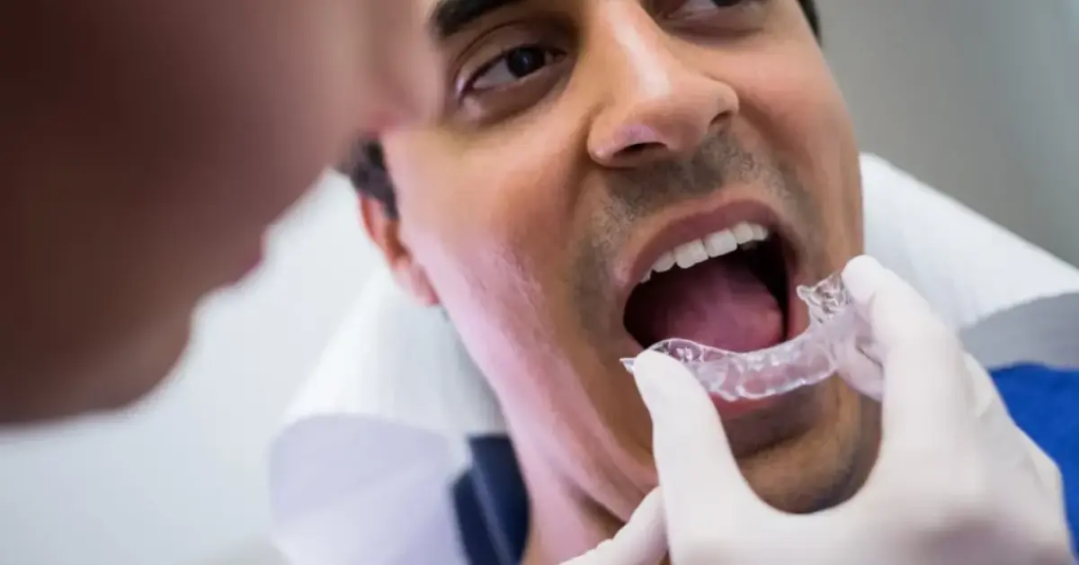 Bruxism Treatment – Custom Nightguards for Teeth Grinding