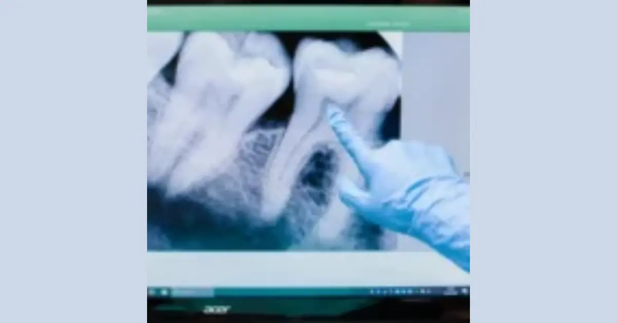 Oral Cancer Screening