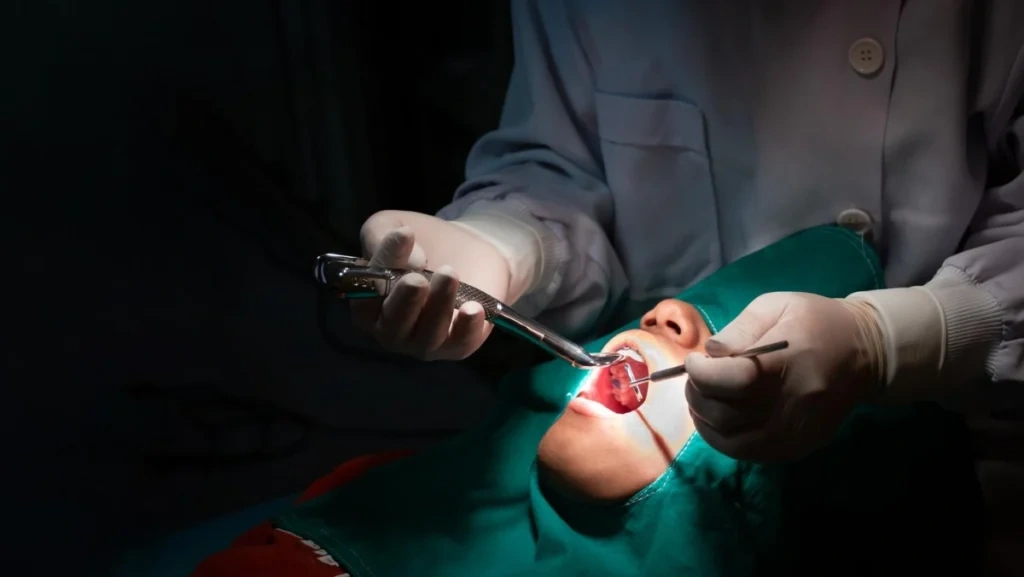 oral surgery