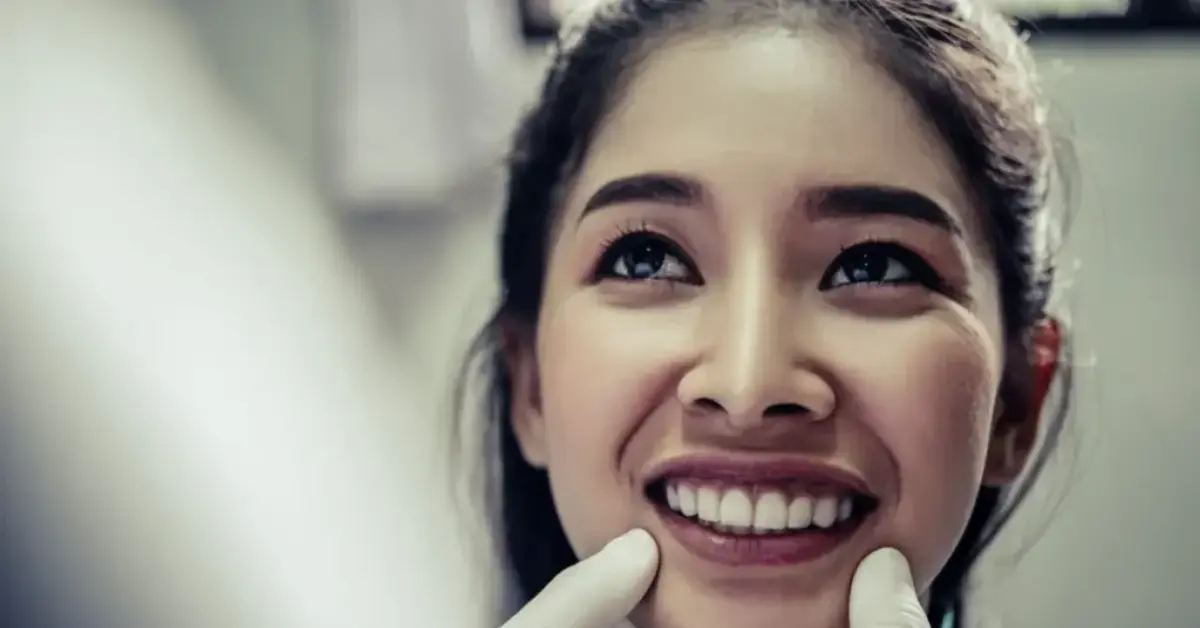 Cosmetic Bonding – Tooth-Colored Resin for Minor Repairs