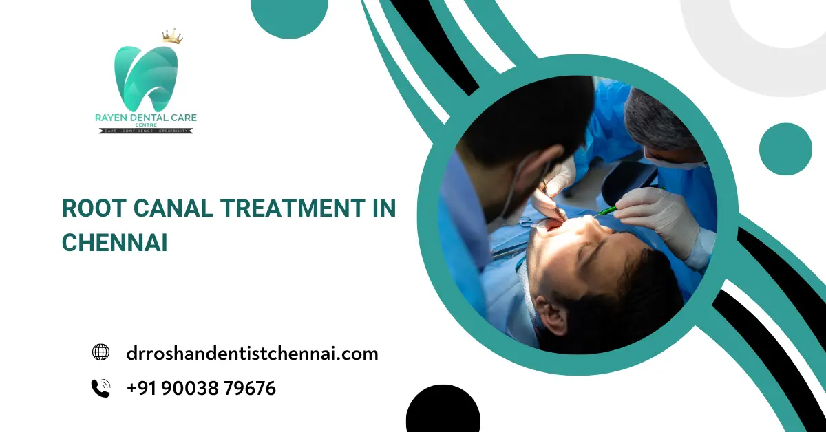 Root Canal Treatment in Chennai