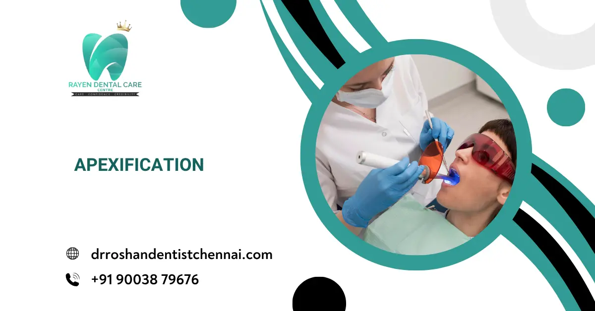 Apexification