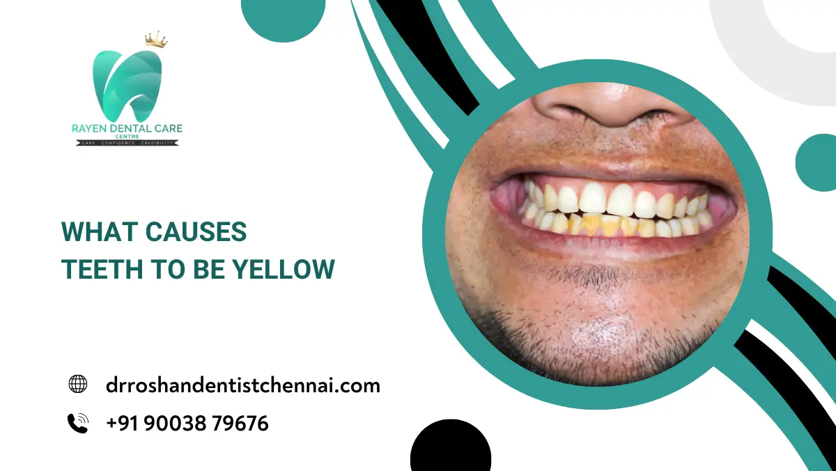 What causes teeth to be yellow