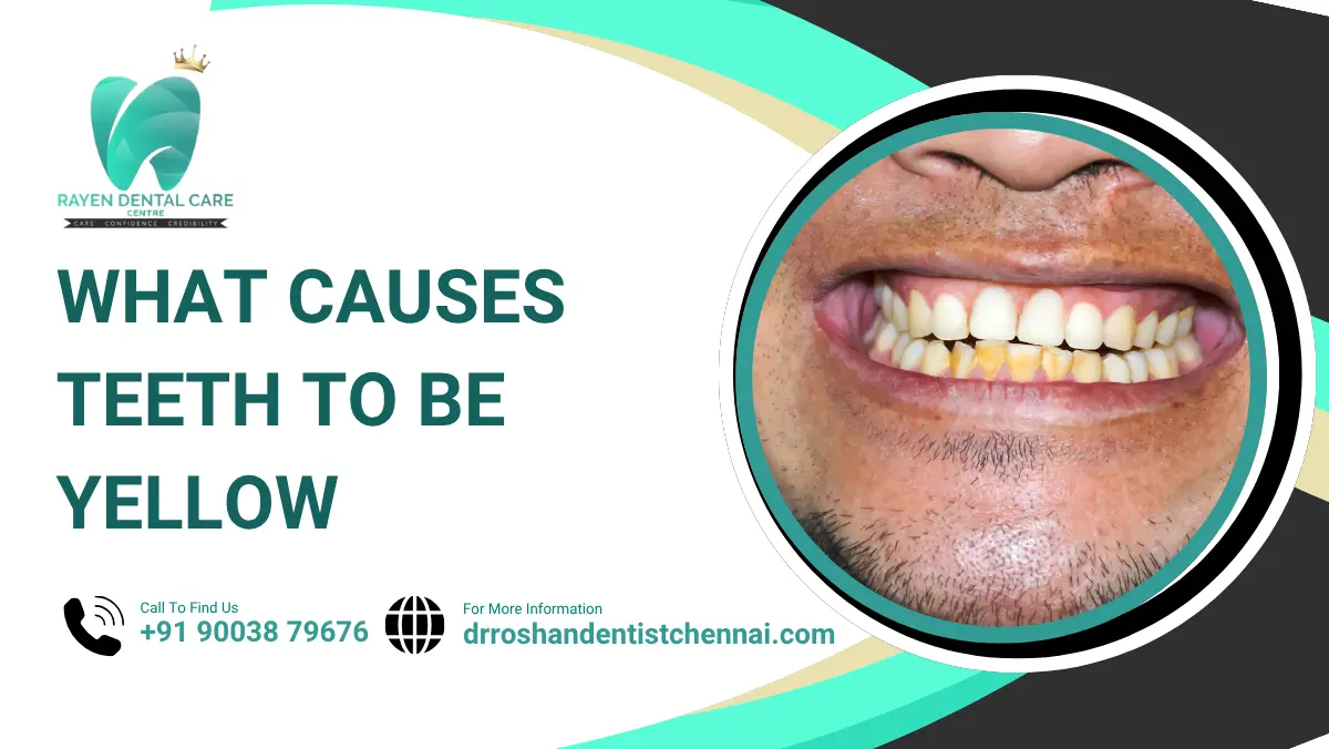 What Causes Teeth to Be Yellow