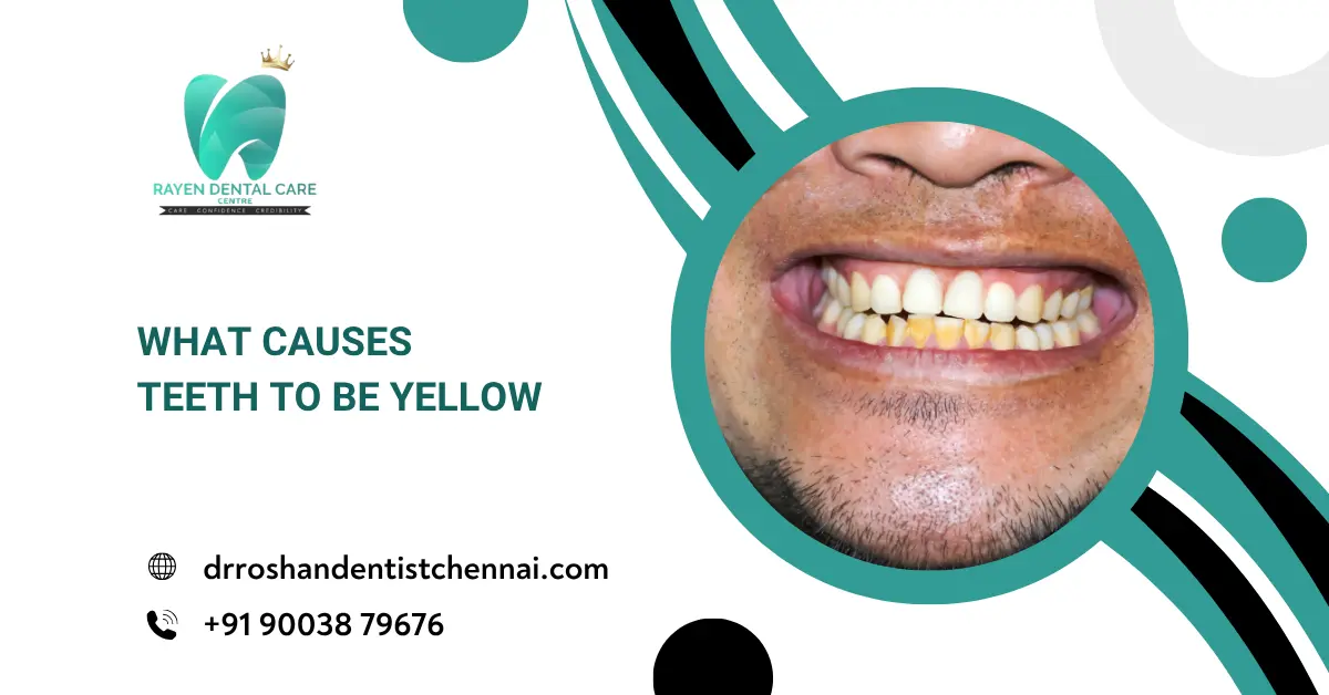 What Causes Teeth to Be Yellow? Top Reasons and How to Fix Them